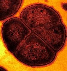 which-of-these-is-most-closely-related-to-d.-radiodurans?