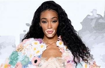 is-jack-harlow-related-to-winnie-harlow