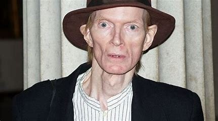 jim-diego-cause-of-death